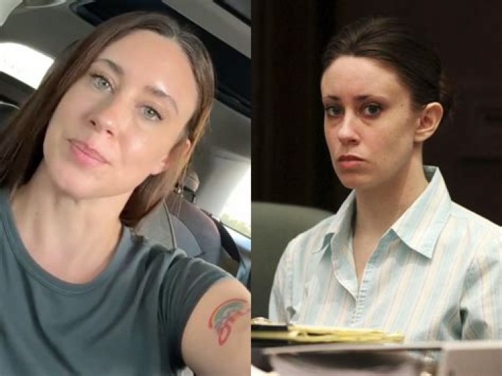 All About Casey Anthony Plastic Surgery