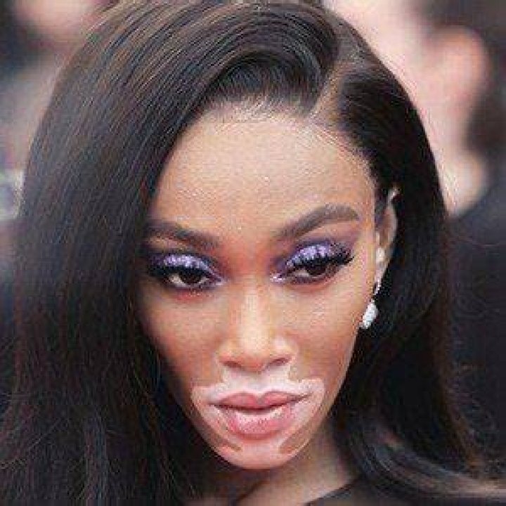 Winnie Harlow age