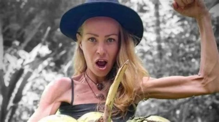 Zhanna Samsonova Anorexia